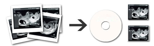 エコー写真をCDと写真にイメージ2